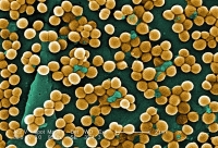 800px-CDC-10046-MRSA